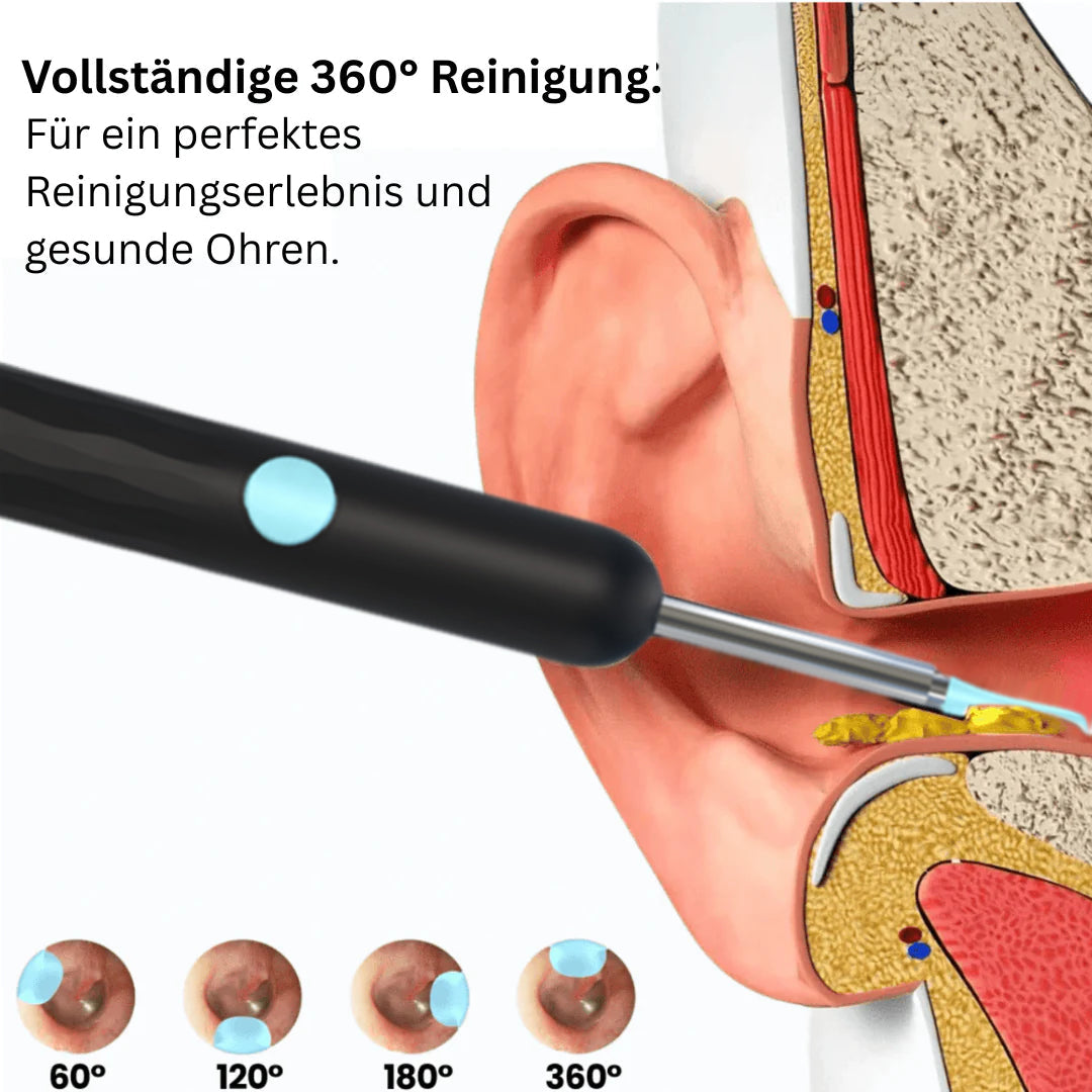 ⏳Limited time 50% discount💥Intelligent waterproof visual earwax remover